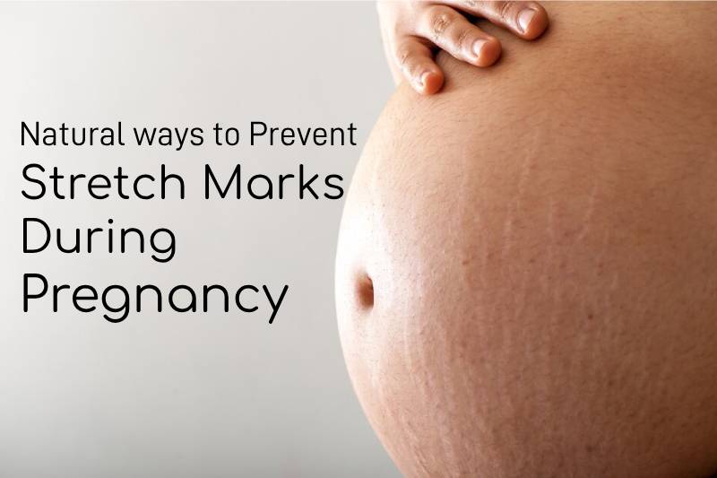 Prevent Stretch Marks during Pregnancy: Remedies and Tips